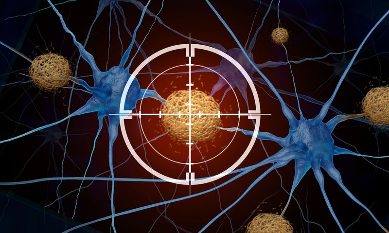 3D representation of neurons with amyloid plaques between them, a hallmark of alzheimer's disease; there is a target crosshair over one of the yellow plaques