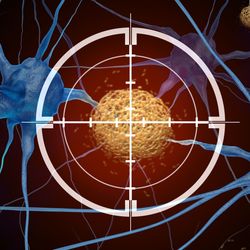 3D representation of neurons with amyloid plaques between them, a hallmark of alzheimer's disease; there is a target crosshair over one of the yellow plaques