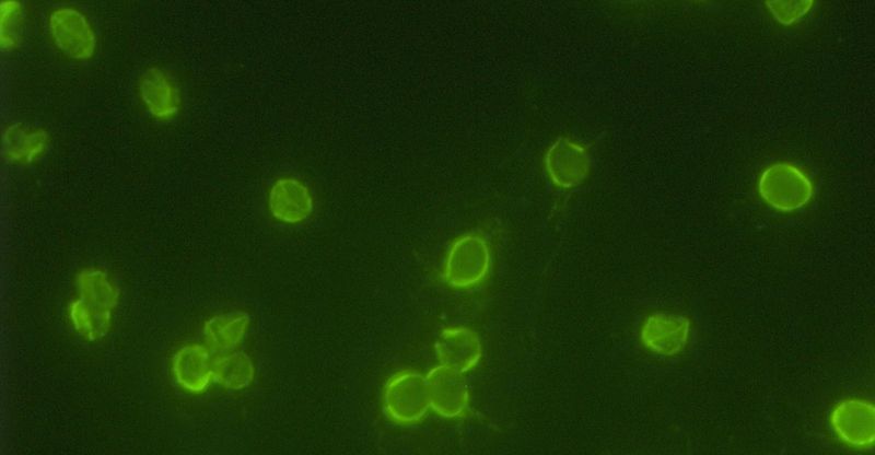 green immunofluorescence image of small circular parasites
