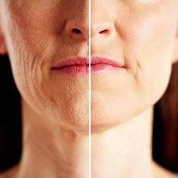 A photo of a woman's face with a line going through the center. The line demarcates a slight age difference in each half. On the left, the woman's face has more wrinkles and looks older, but on the right there is more light and her skin is smoother. 