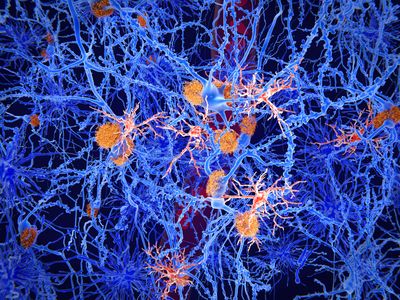 illustration of orange microglia within blue brain tissue