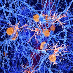 illustration of orange microglia within blue brain tissue