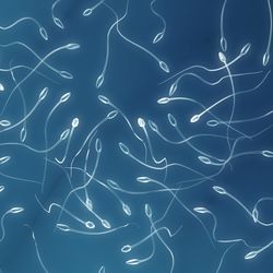 A digital photo showing sperm cells clustered together on a blue background. 