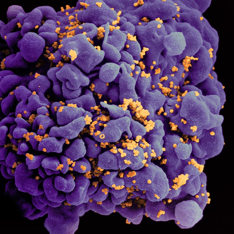 Scanning electron micrograph of an HIV-infected H9 T cell, colorized in Halloween colors