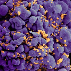 Scanning electron micrograph of an HIV-infected H9 T cell, colorized in Halloween colors