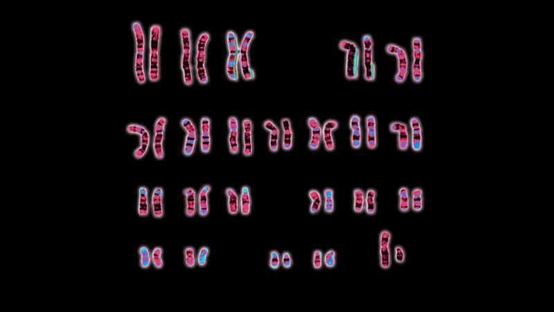 Normal male 46,XY human karyotype