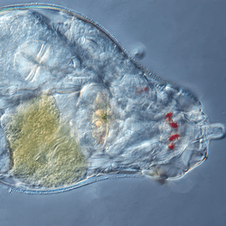 Bdelloid rotifer under a microscope.